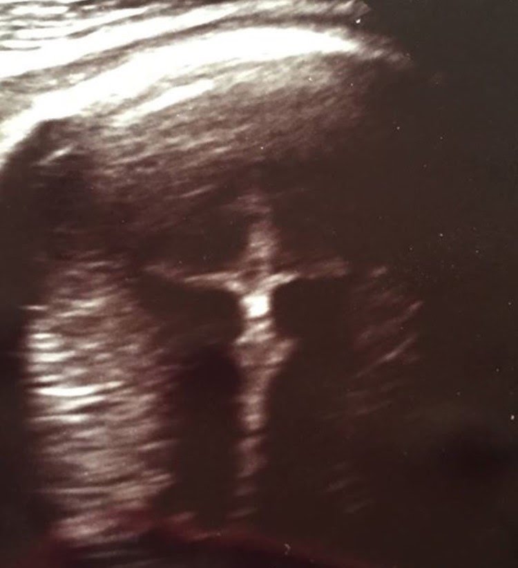 Indiana Woman Spots “Divine Image” in Ultrasound…Check it out!